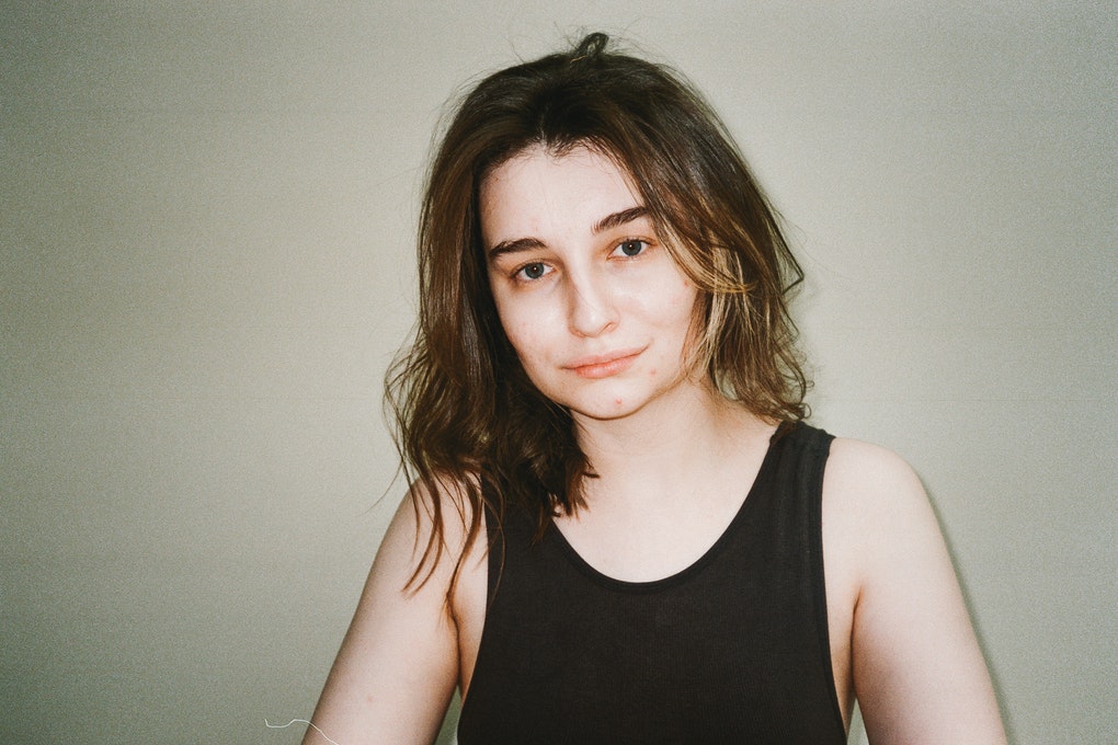acne and new ways to treat acne at dermoi!