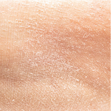 dry skin facial treatment