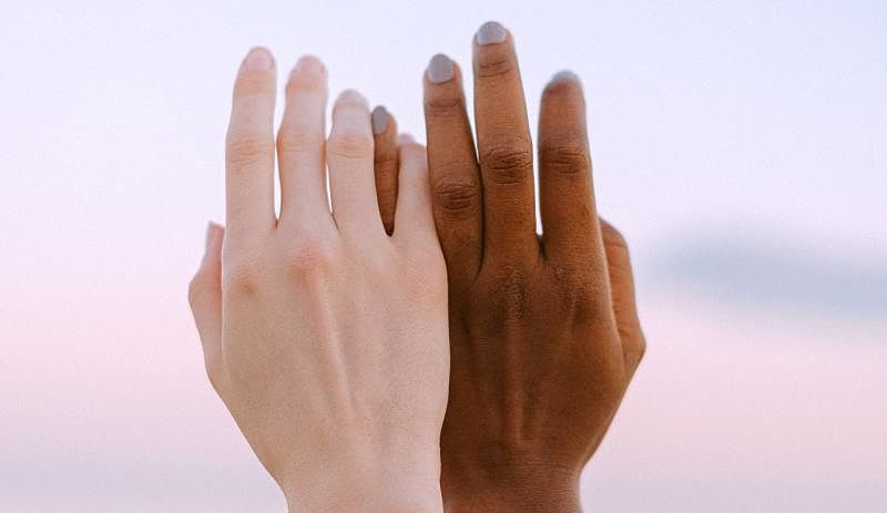 skin pigmentation