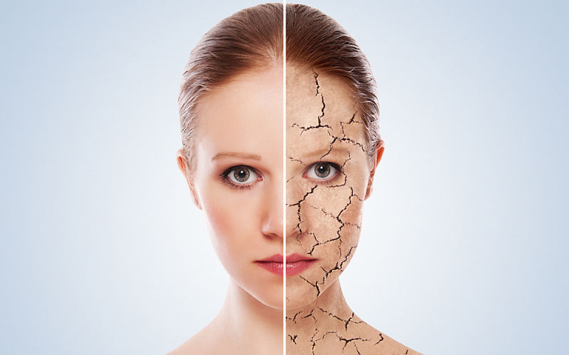 skinglo-ageing-crack