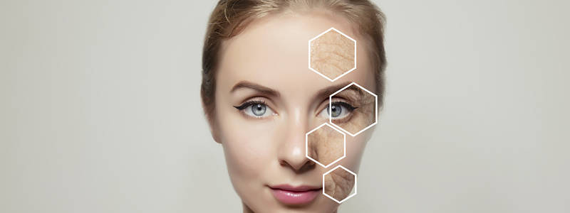 facial treatment
